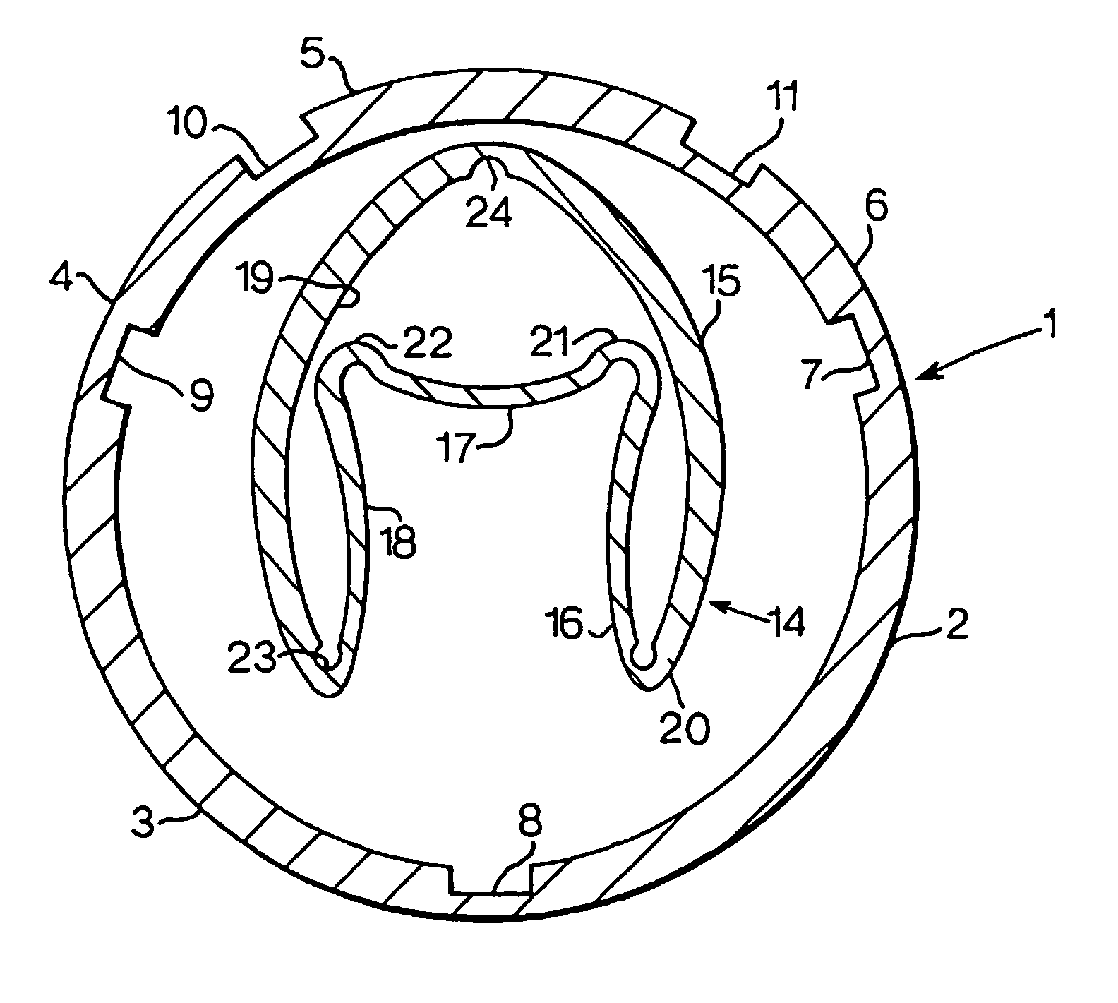Contractable and expandable tubular wellbore system