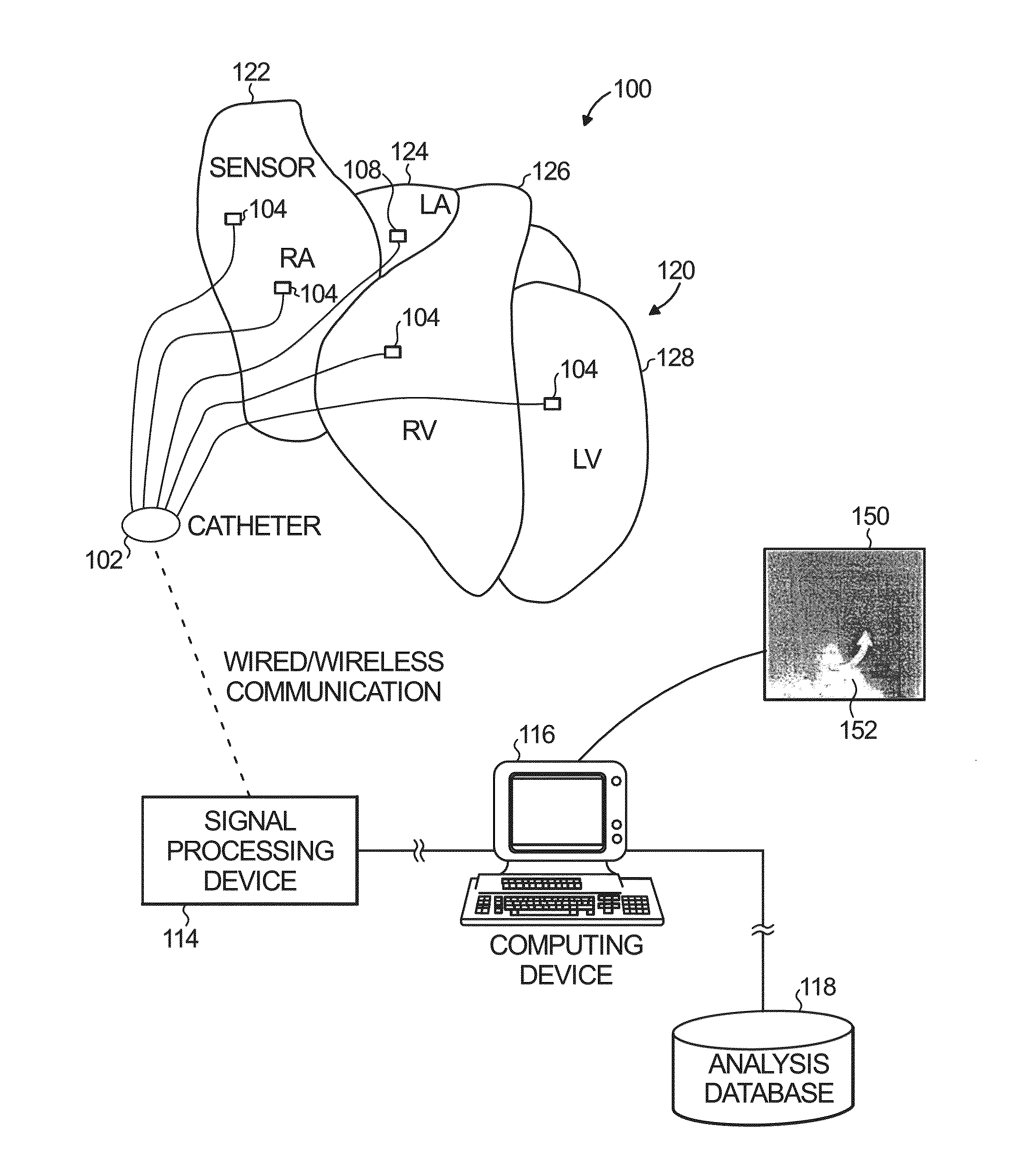 System and method of identifying sources associated with biological rhythm disorders