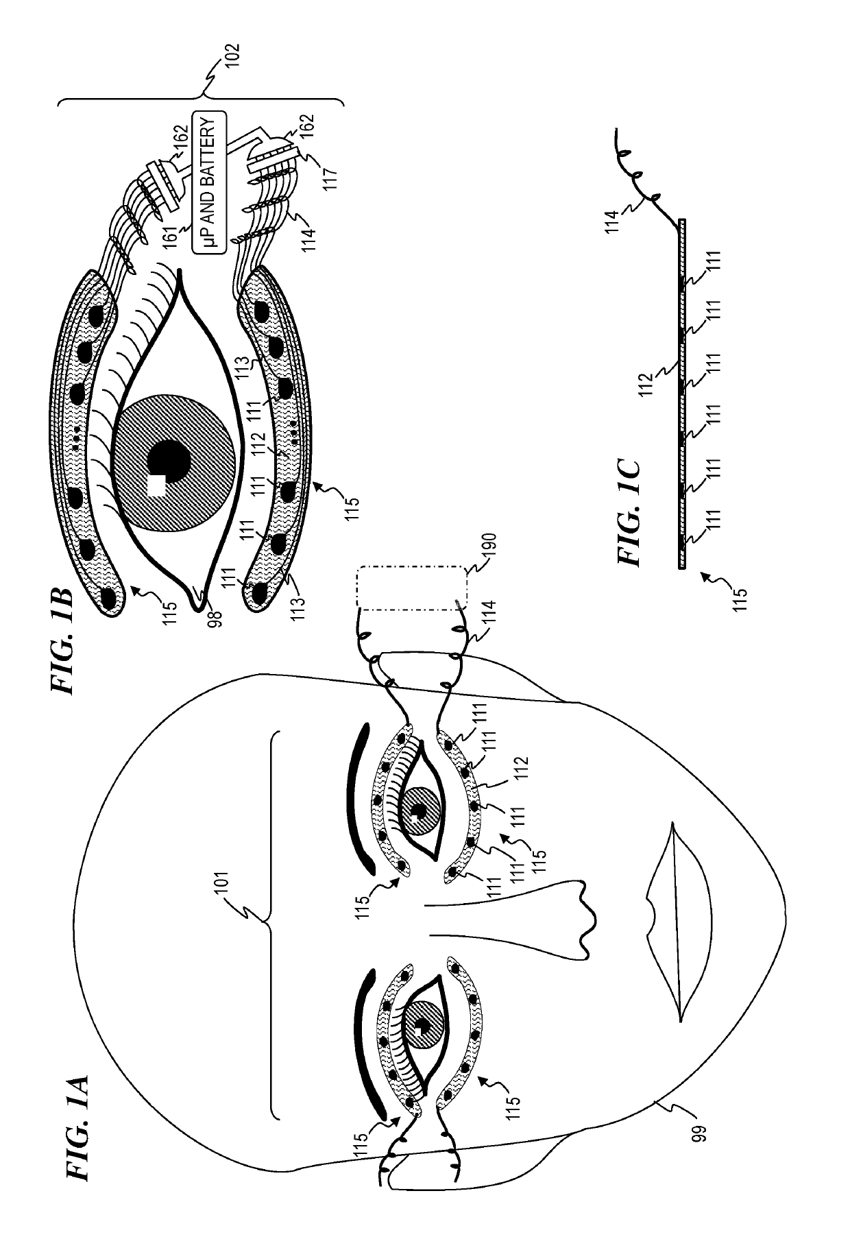 Apparatus and method for ocular microcurrent stimulation therapy