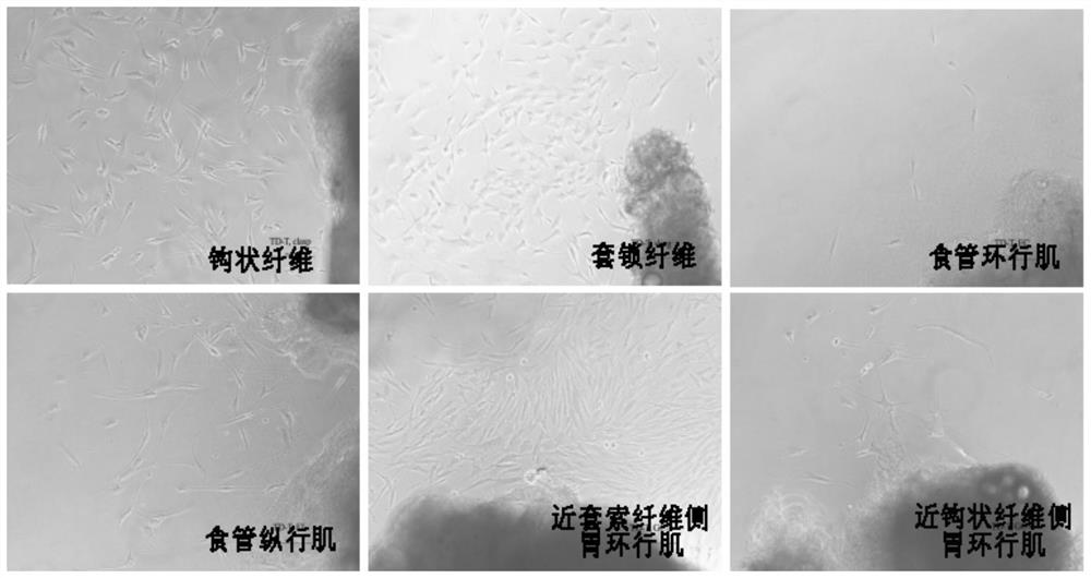 A method for primary culture and identification of esophagogastric junction smooth muscle cells by tissue block method