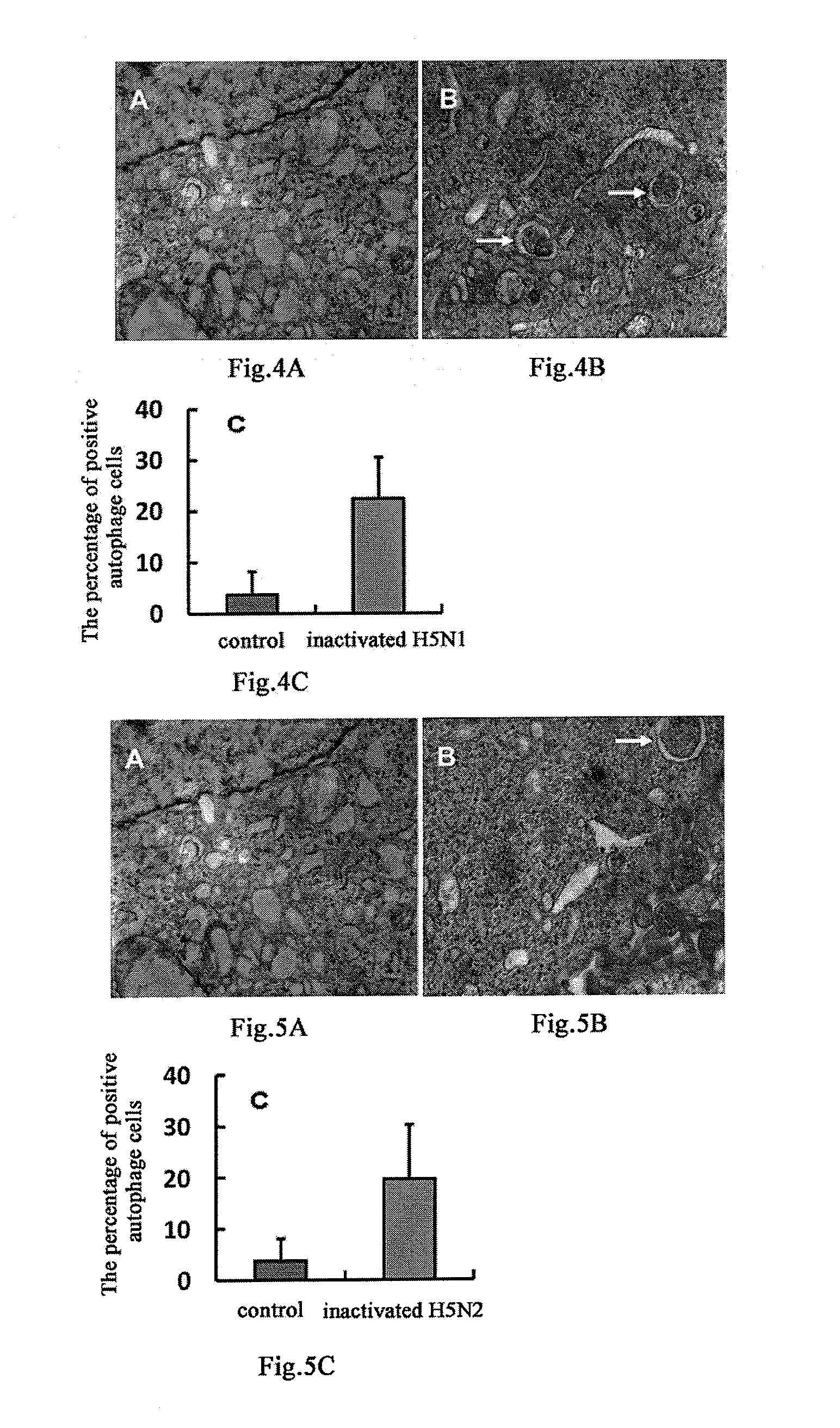 Use of cell autophagy (type ii cell apoptosis) inhibitors