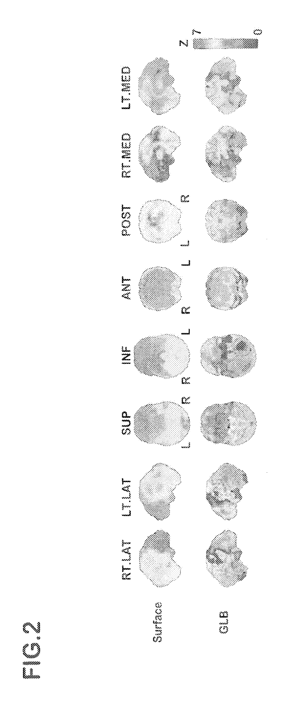 Device for creating database of alternative normal brain