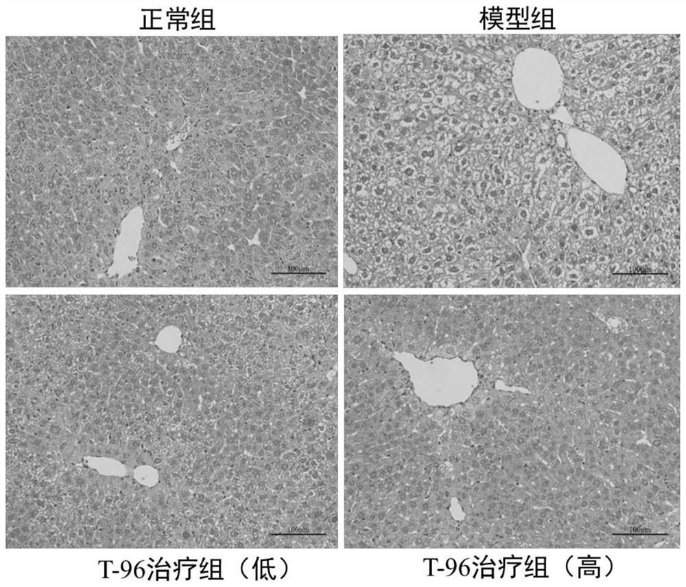 Application of Demethylzeylasteral (T-96) in preparation of drugs for preventing or treating hepatic fibrosis