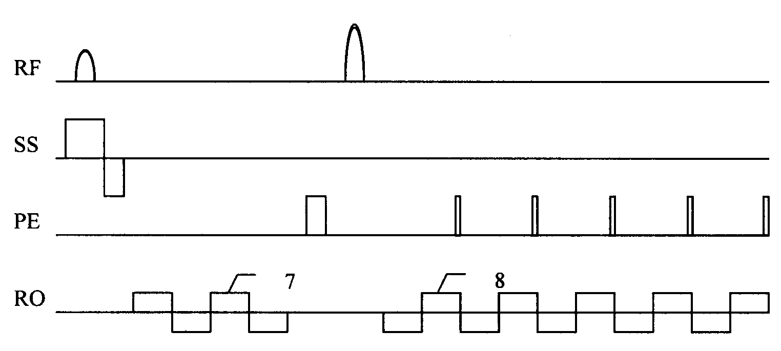 Method for correcting echo wave plane imaging sequence