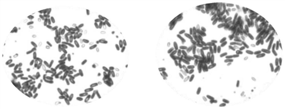 Method for producing glutamic acid by using corynebacterium glutamicum