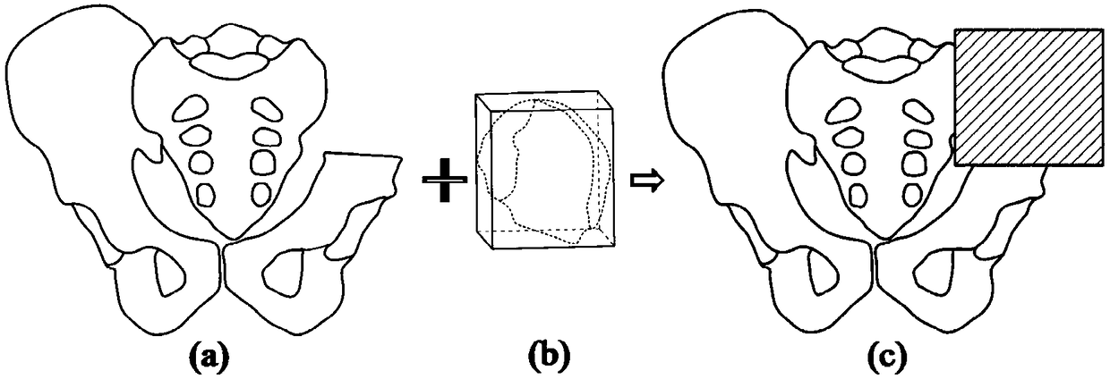 Designing method of customized pelvis embedded prosthesis based on topological structural optimization