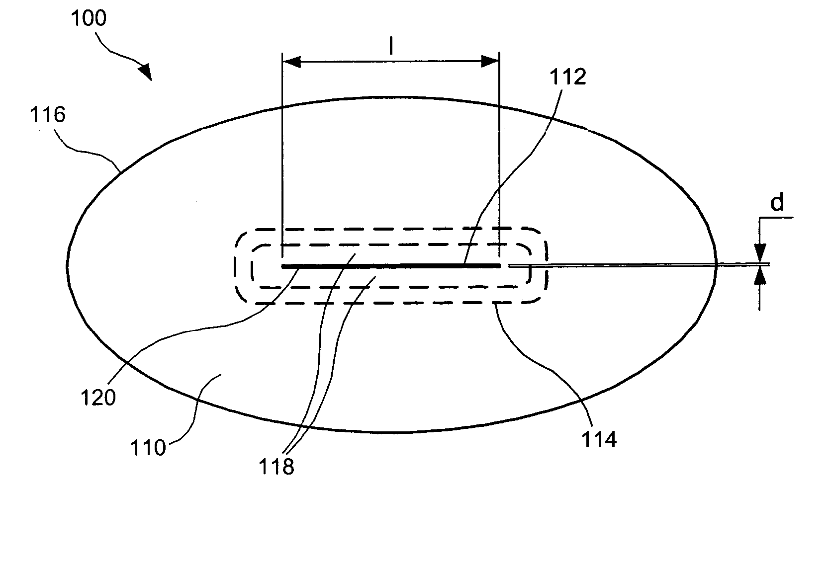Pressure actuated valve with improved slit configuration