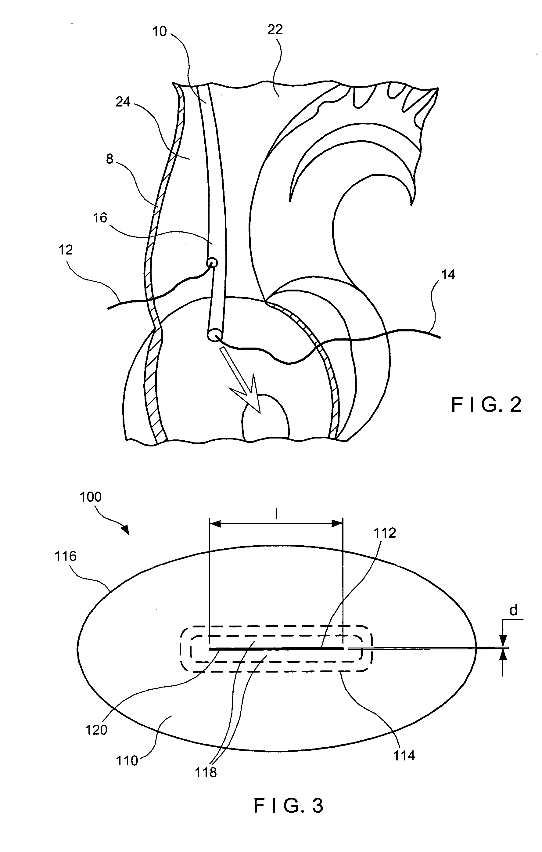 Pressure actuated valve with improved slit configuration