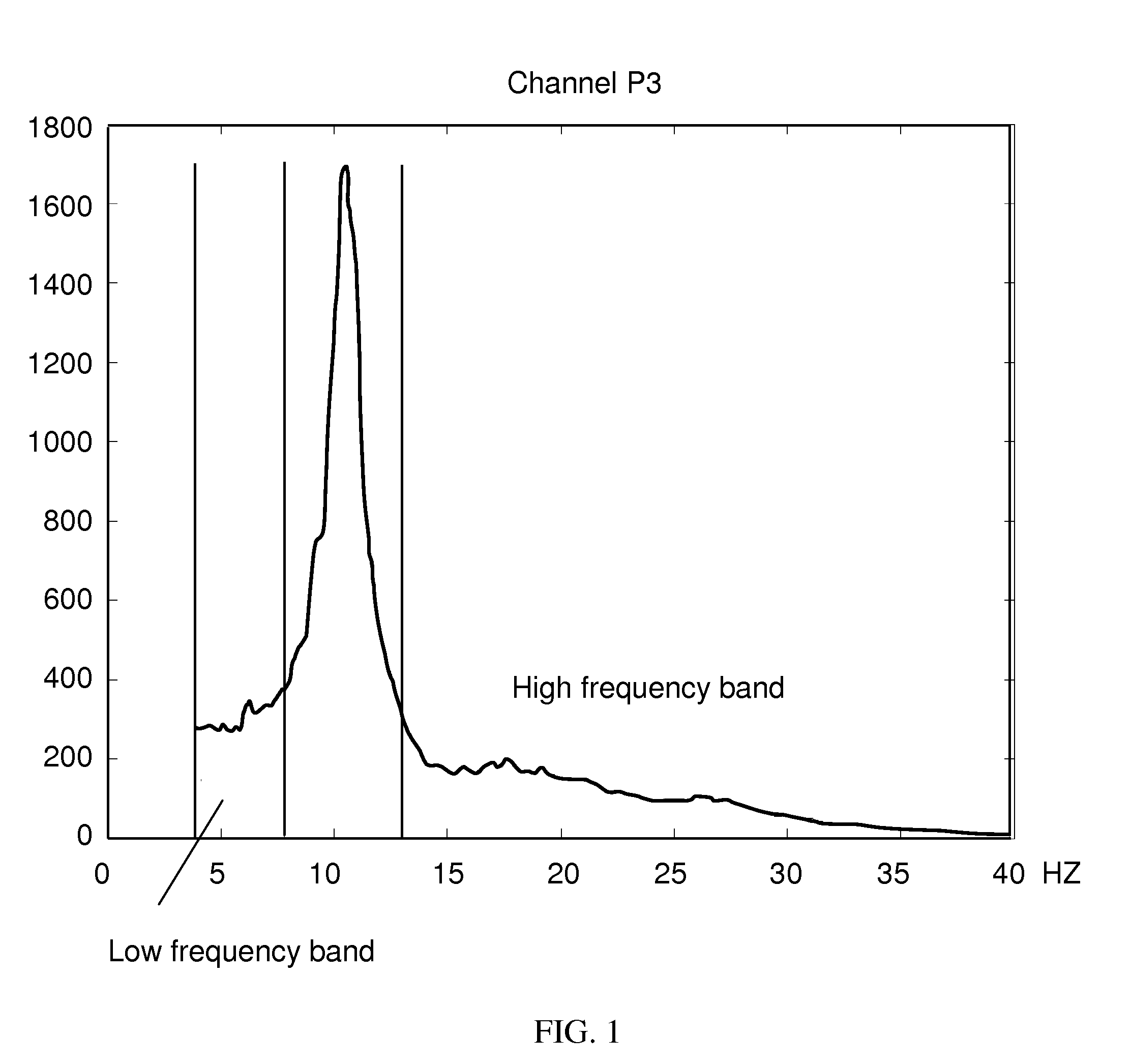 Method and device for determining depressive disorders by measuring bioelectromagnetic signals of the brain