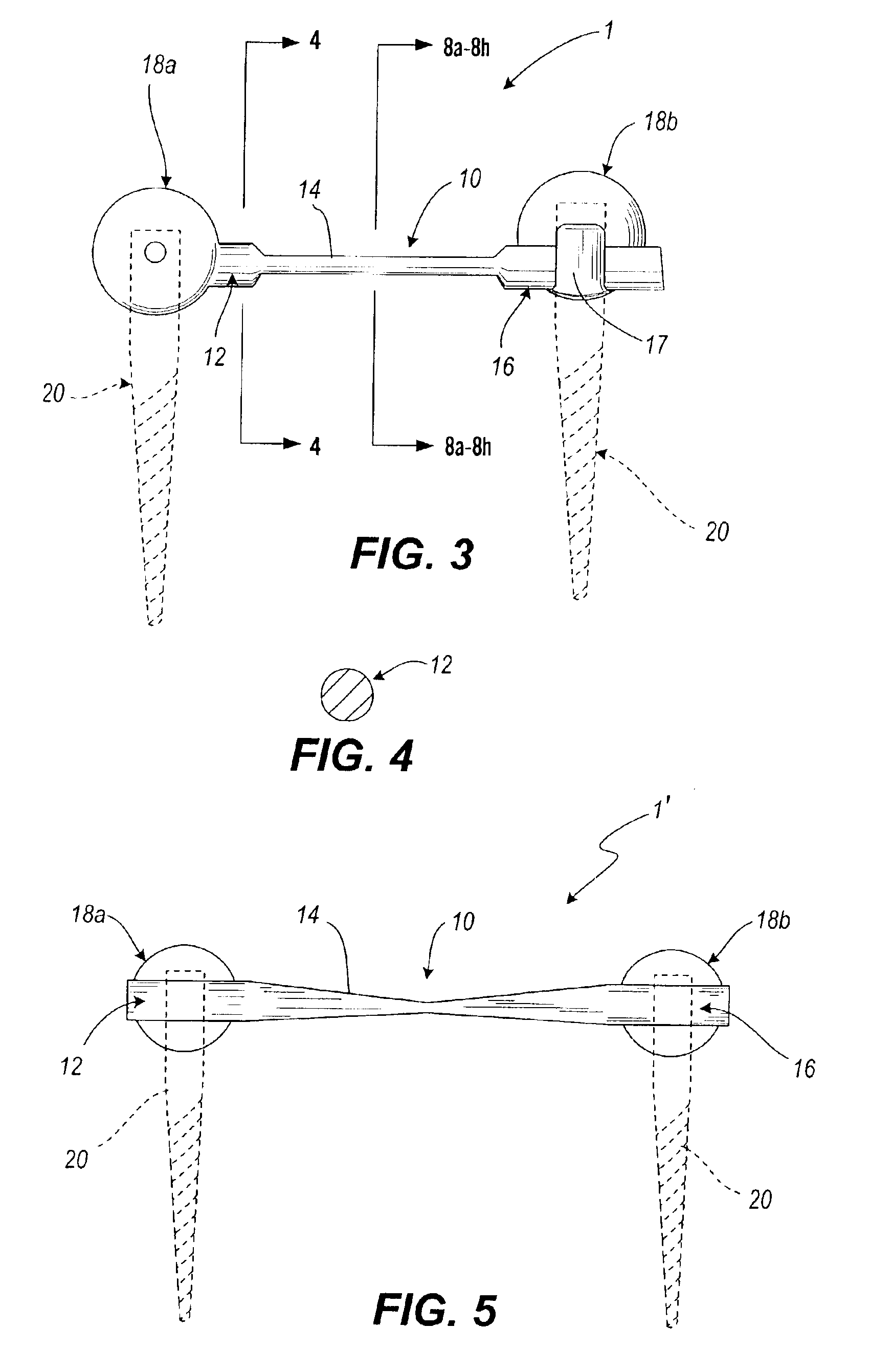 Dynamic fixation device and method of use