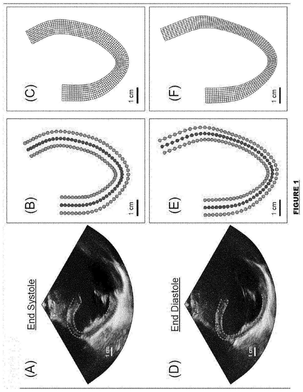 Non-invasive estimation of the mechanical properties of the heart
