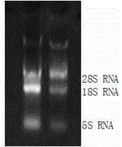 Leukemia single-chain antibody library, as well as construction method and application thereof