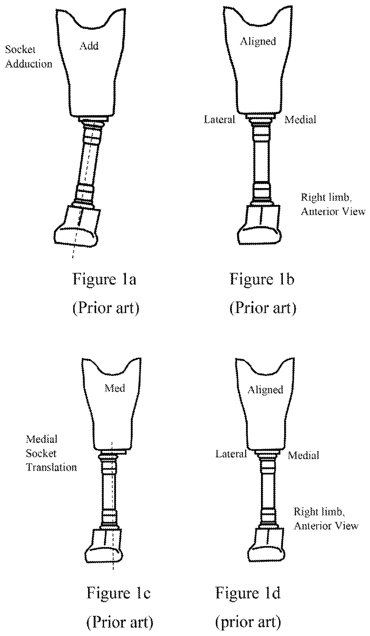 Adapter for self-alignment in 3 dimensional planes for passive prosthetics