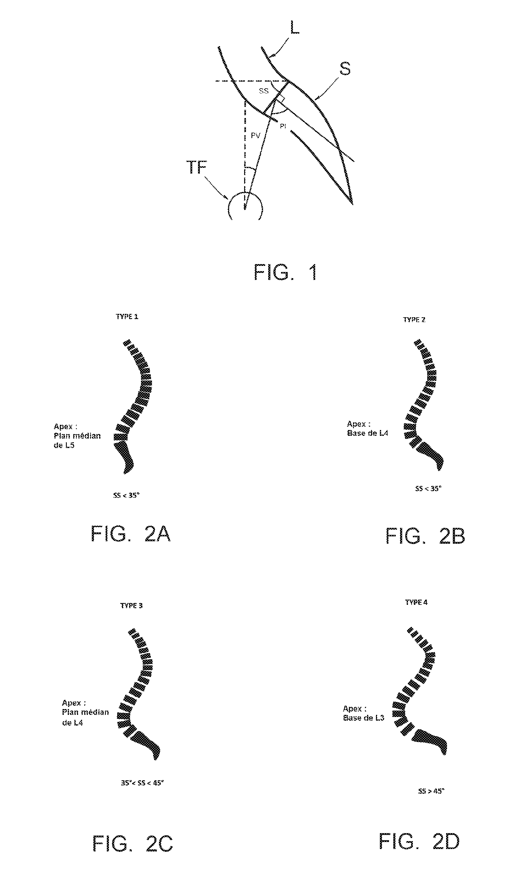 Method making it possible to produce the ideal curvature of a rod of vertebral osteosynthesis material designed to support a patient's vertebral column