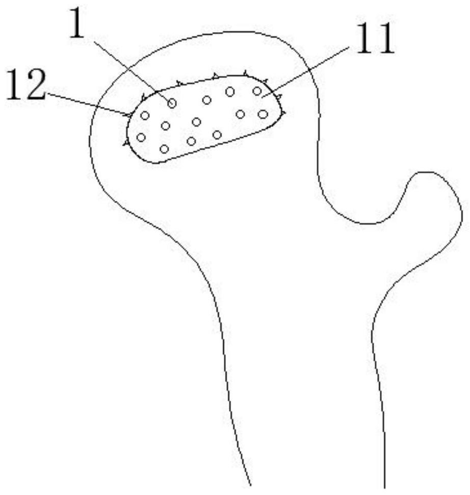 Module for filling and supporting femoral head necrosis area and manufacturing and using method thereof