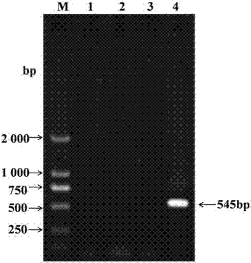 Detection method for A, B, J subgroup avian leucosis viruses in avian infectious laryngotracheitis live vaccine