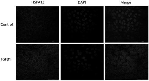 SiRNA interfering with HSPA13 expression and application thereof