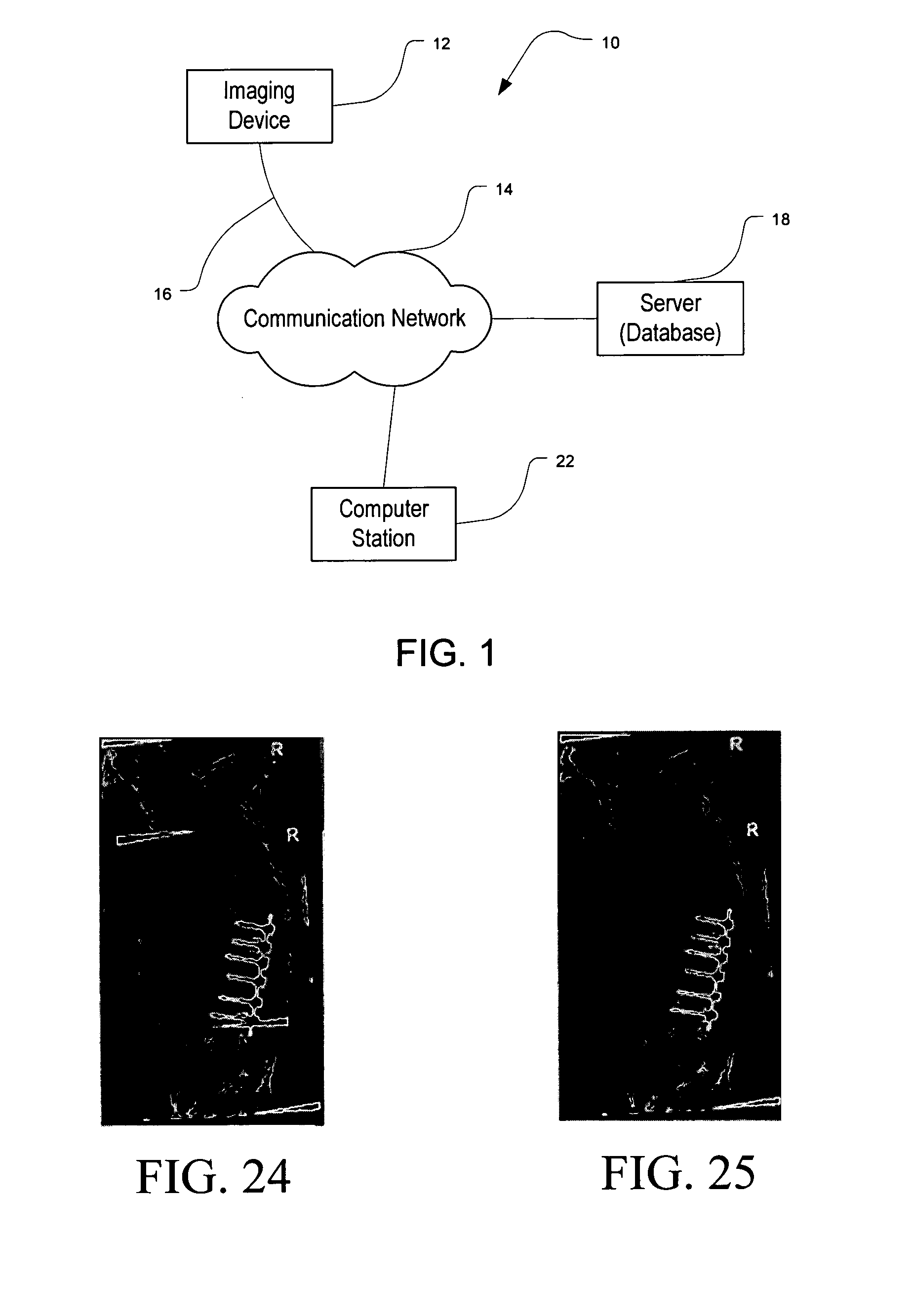 Methods and systems for combining a plurality of radiographic images