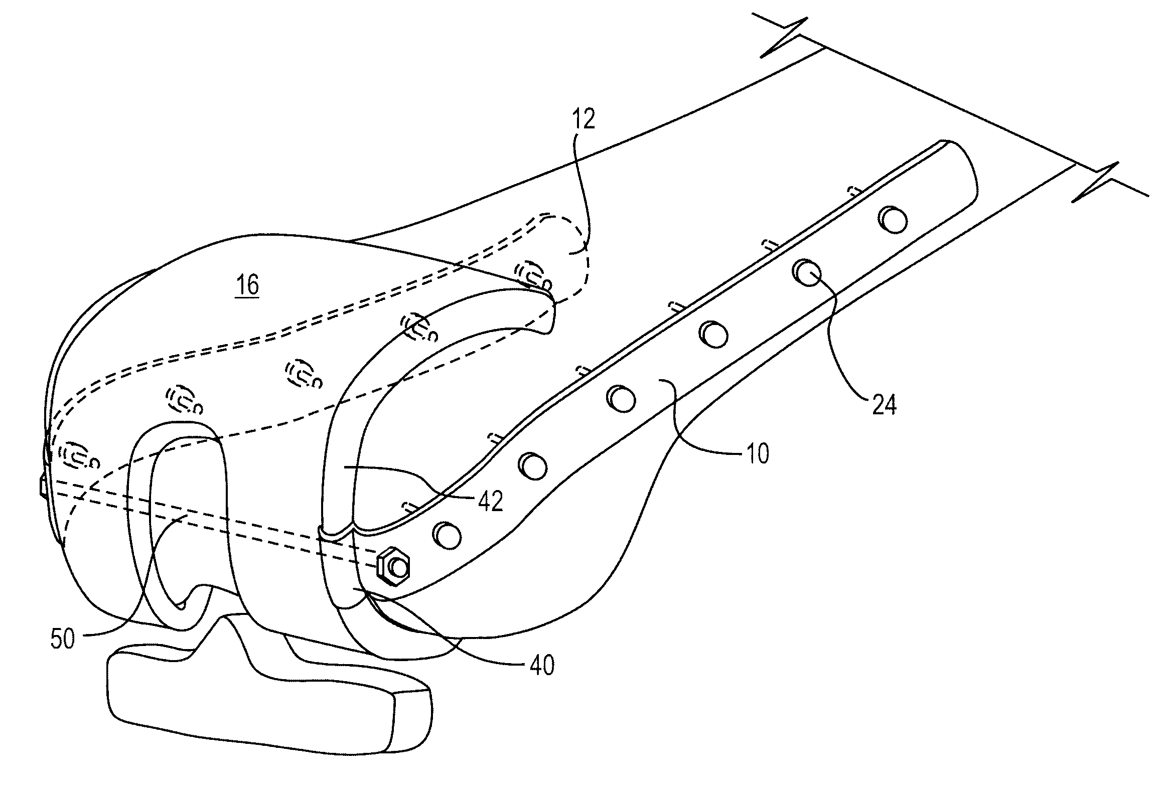 Method and apparatus for treating periprosthetic fractures of the distal femur