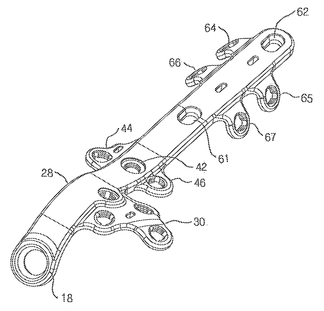 Lateral ankle fusion plate system and jig, and method for use therewith