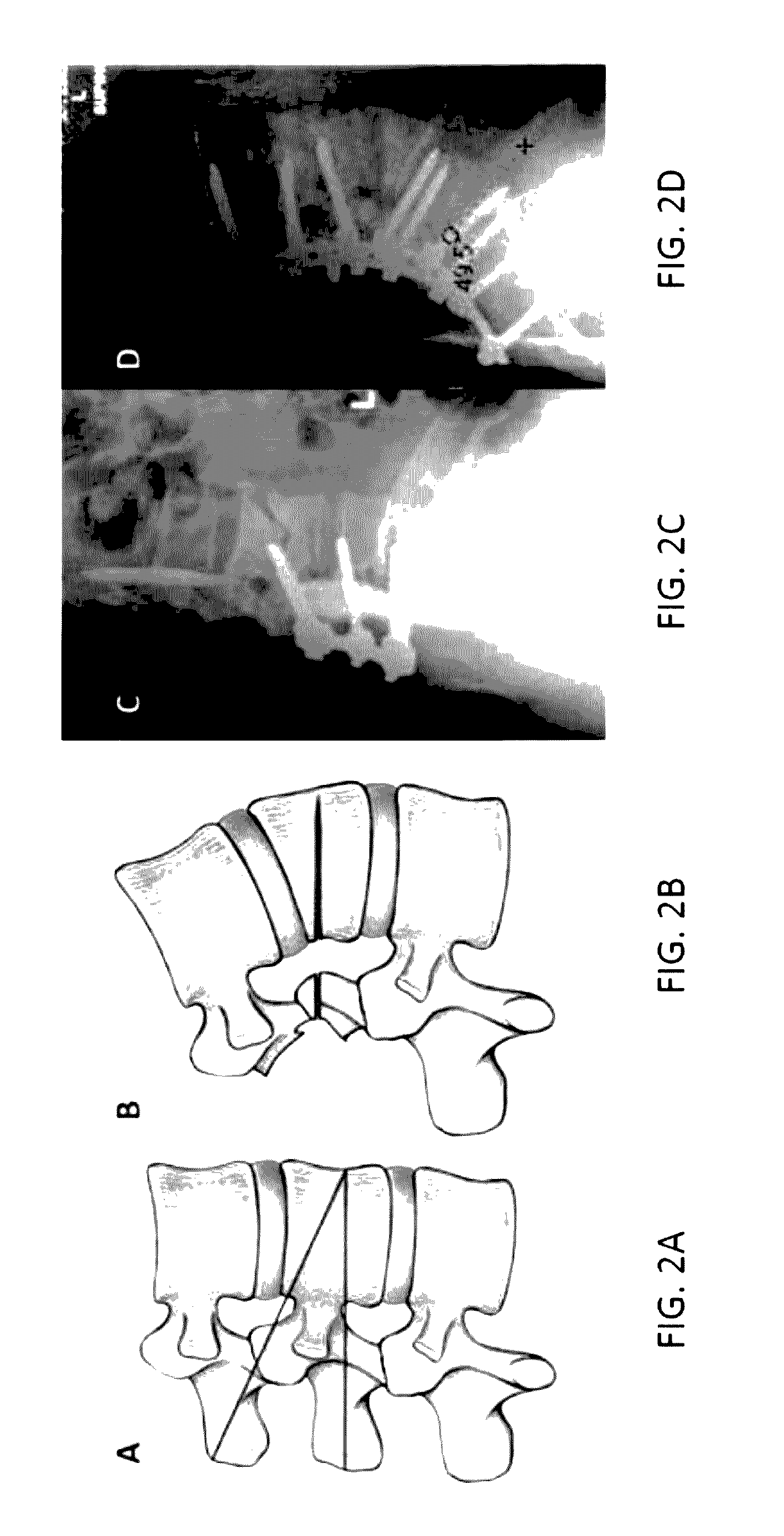 Robotic surgical systems and methods