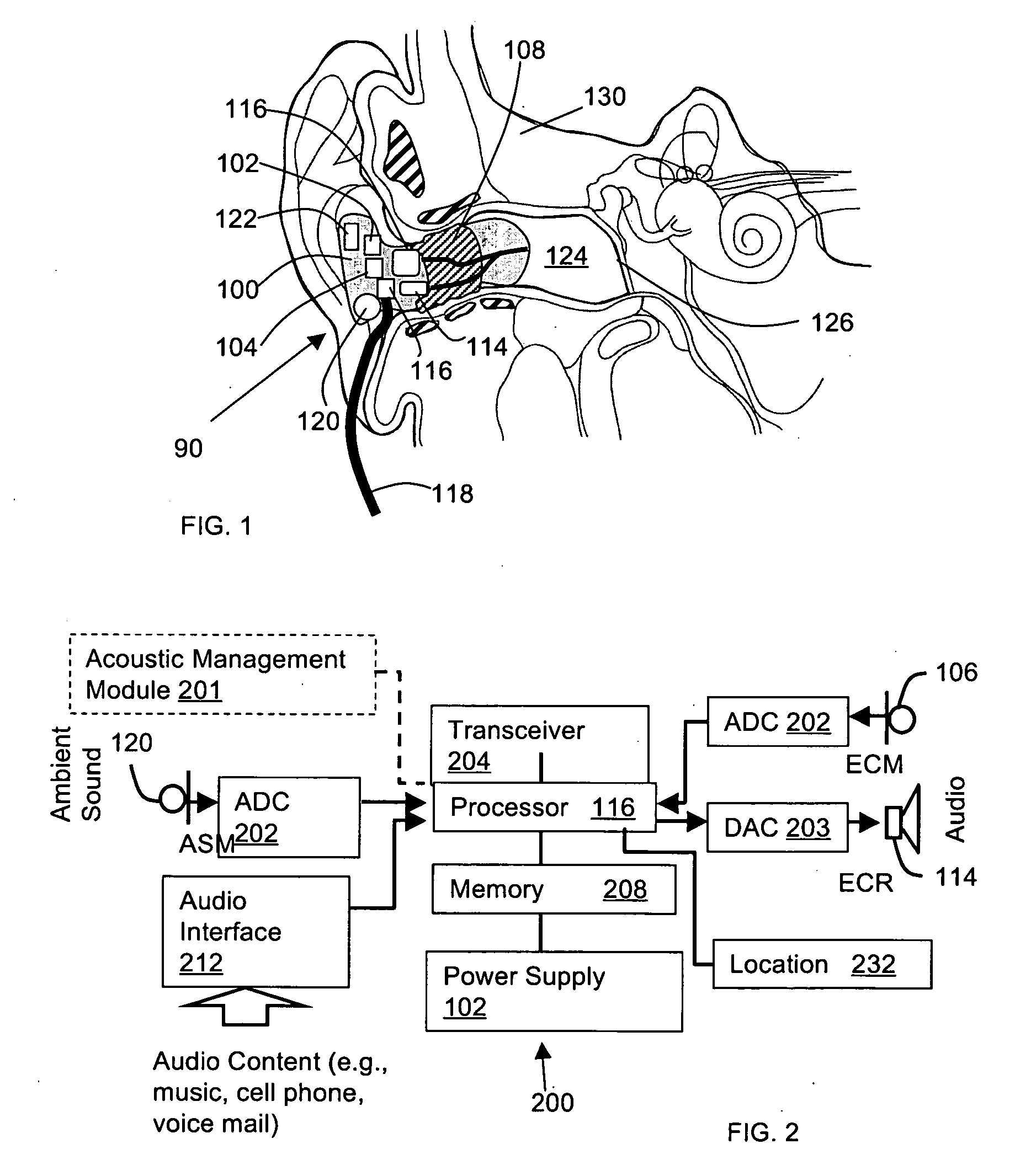 Device and method for remote acoustic porting and magnetic acoustic connection