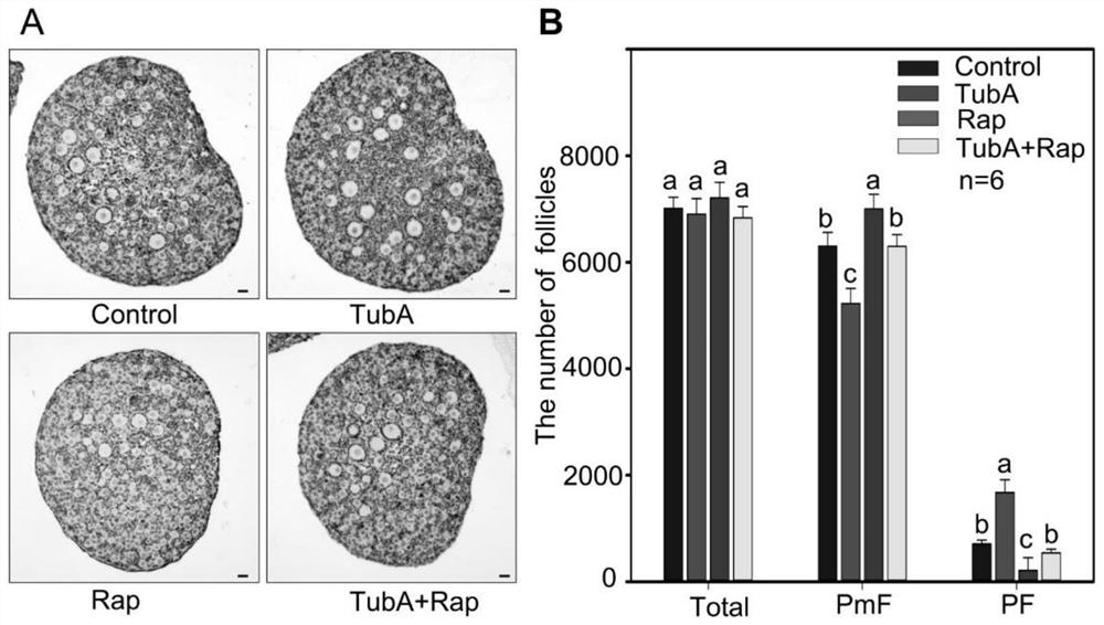 Application of Tubastatin A in preparation of in-vitro activating agent for primordial follicles