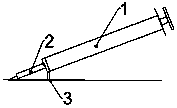 Skin test needle and application thereof