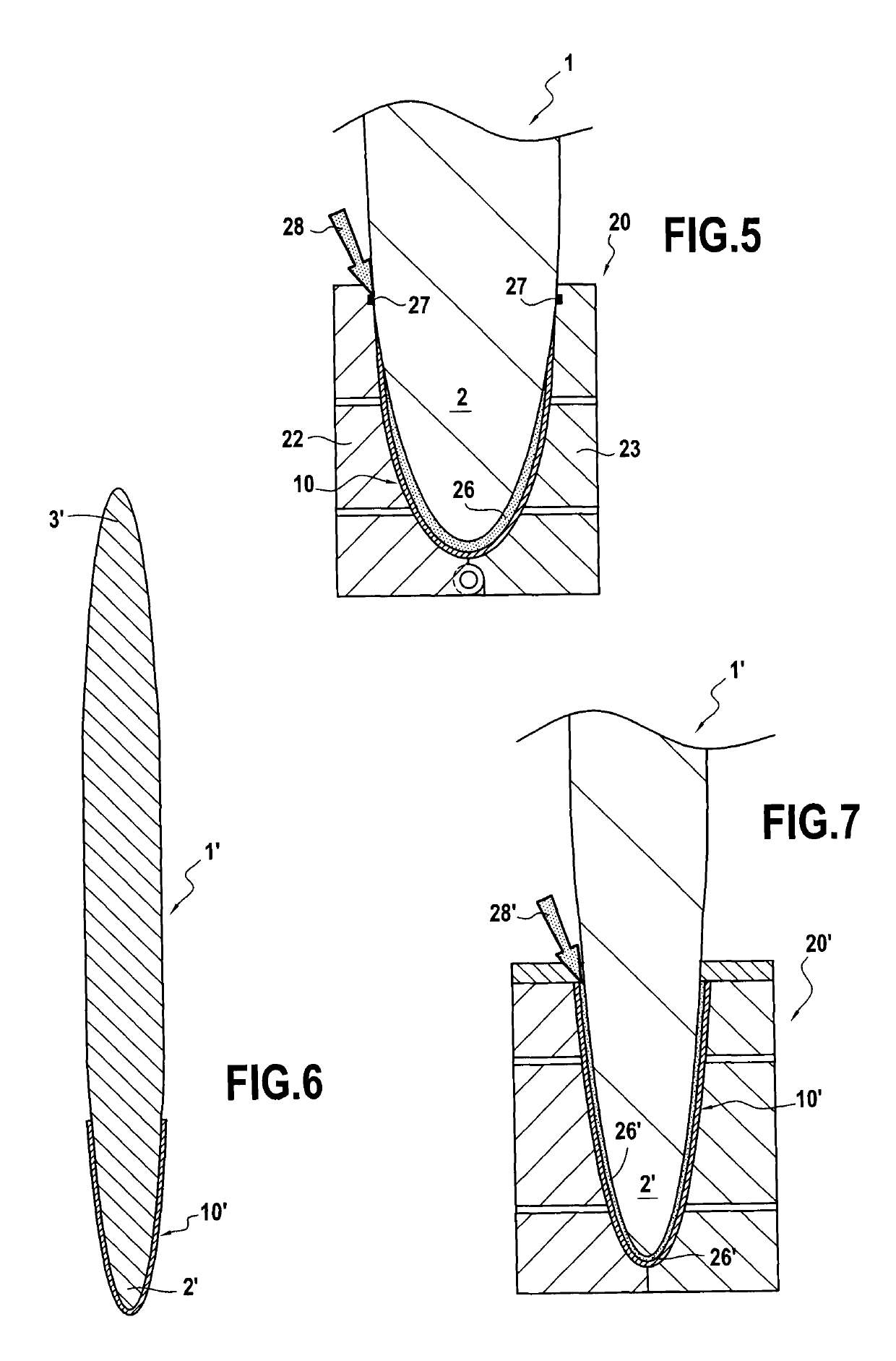 Method of fastening structural metal reinforcement on a portion of a gas turbine blade made of composite material, and an injection mold for performing such a method