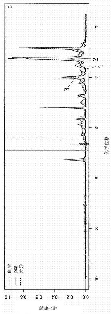 Method for analyzing nmr spectra of lipoprotein-containing samples