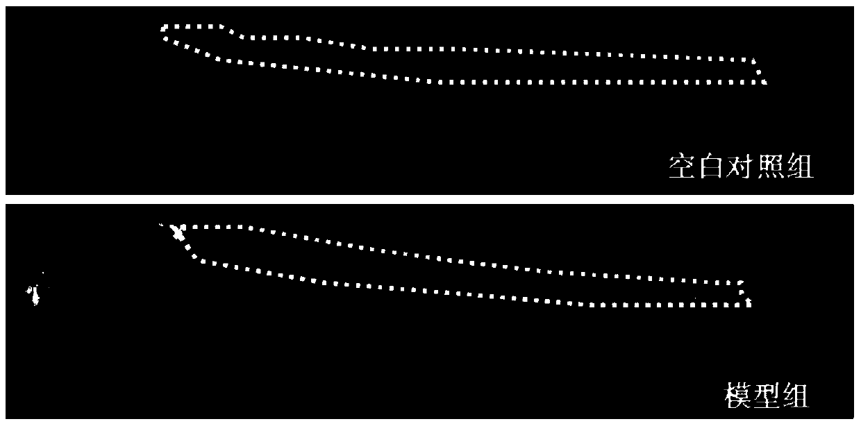 A method for analyzing differentially expressed proteins associated with neuronal injury