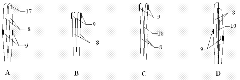Radio frequency cable controlled ablation catheter system for removing sympathetic nerve from kidney