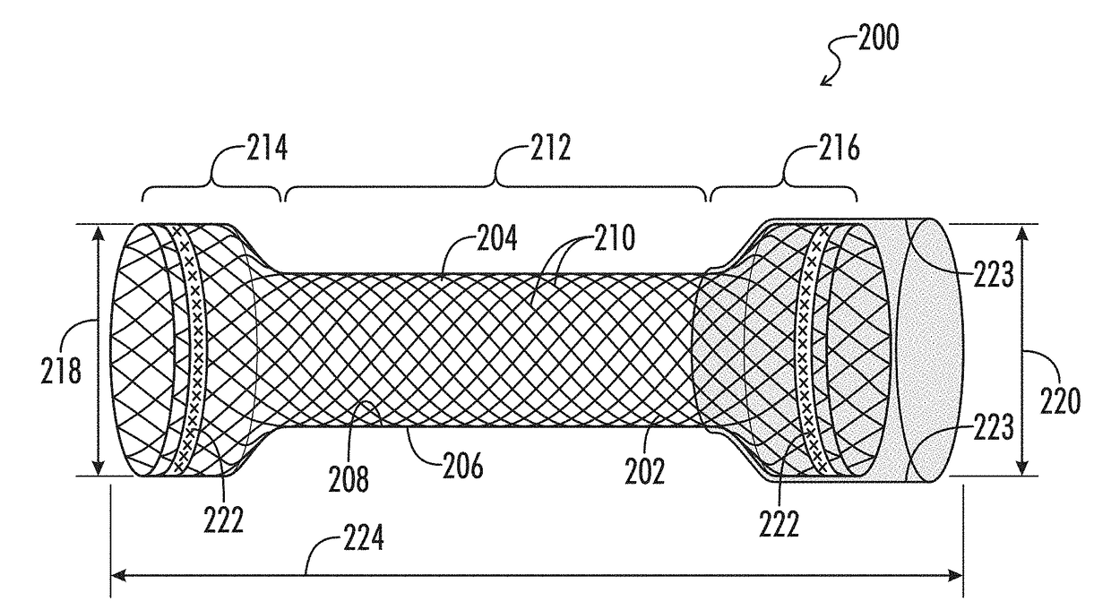 Stents with improved fixation