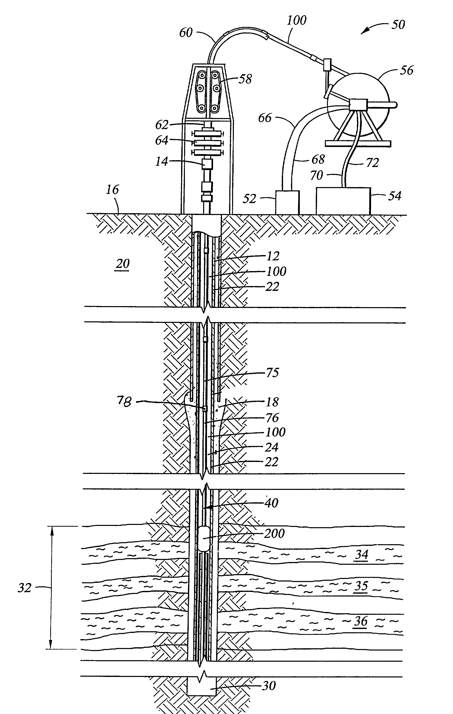 Well treatment apparatus and method