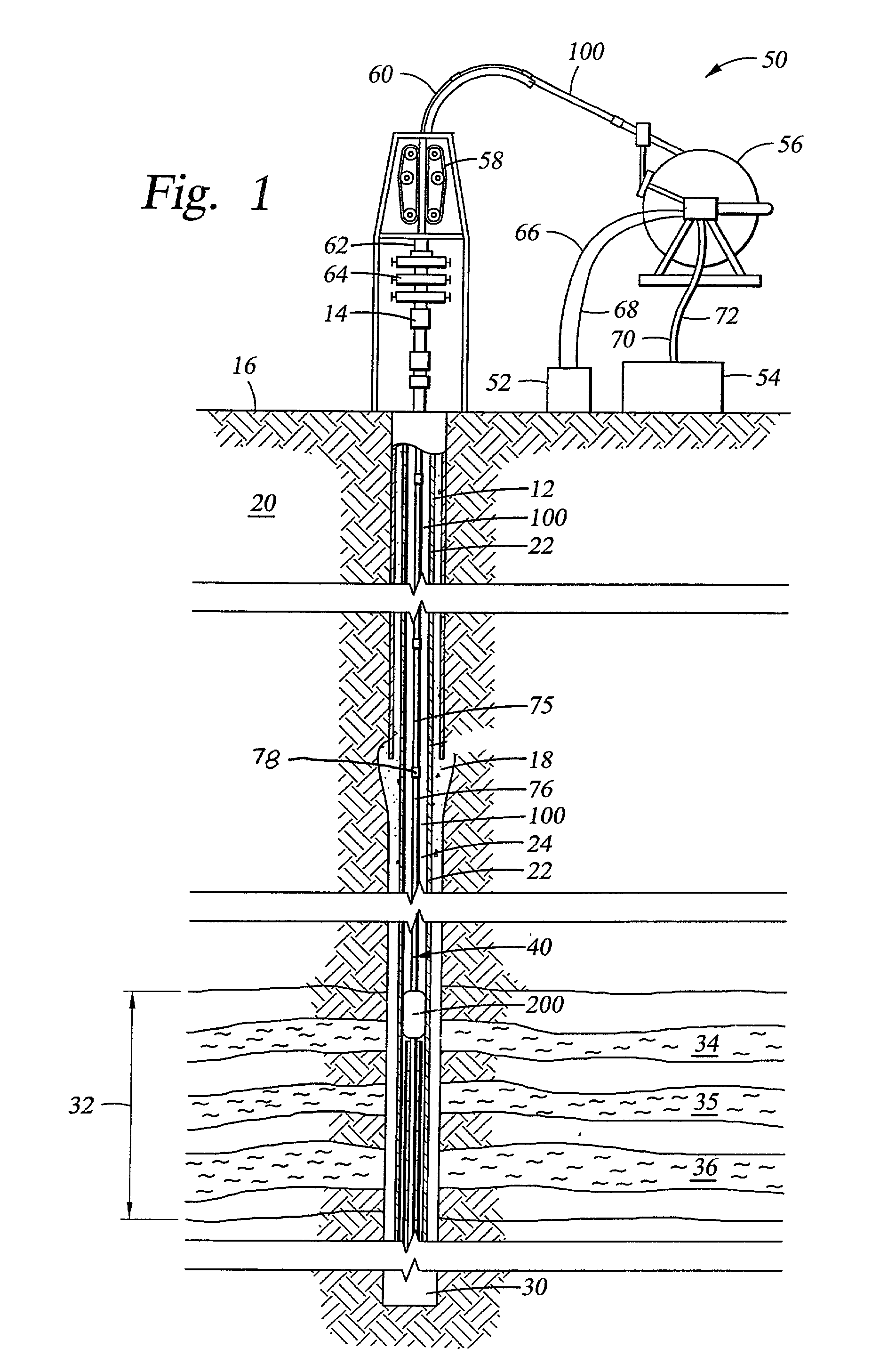 Well treatment apparatus and method