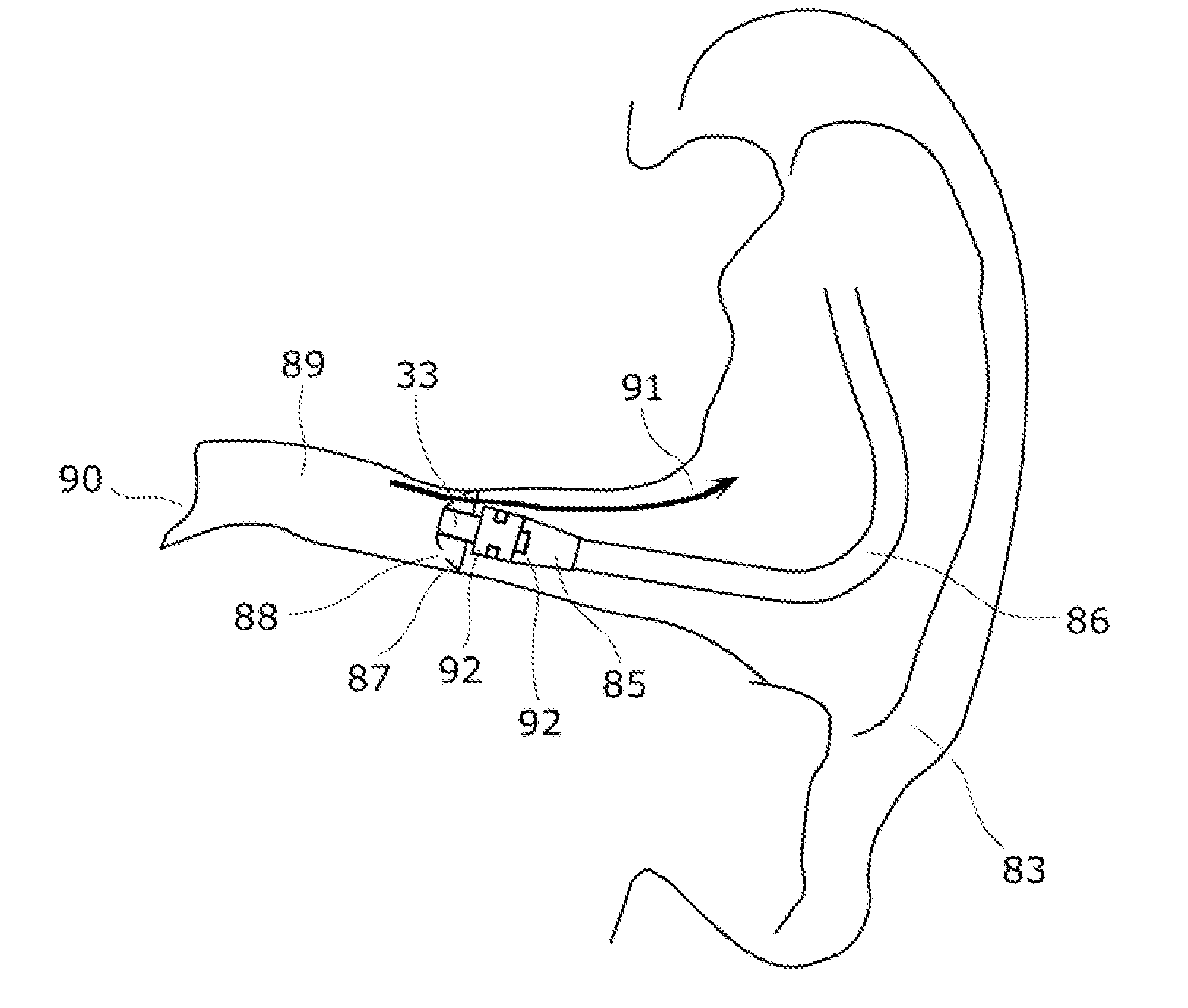 Speaker, hearing aid, earphone, and portable terminal device