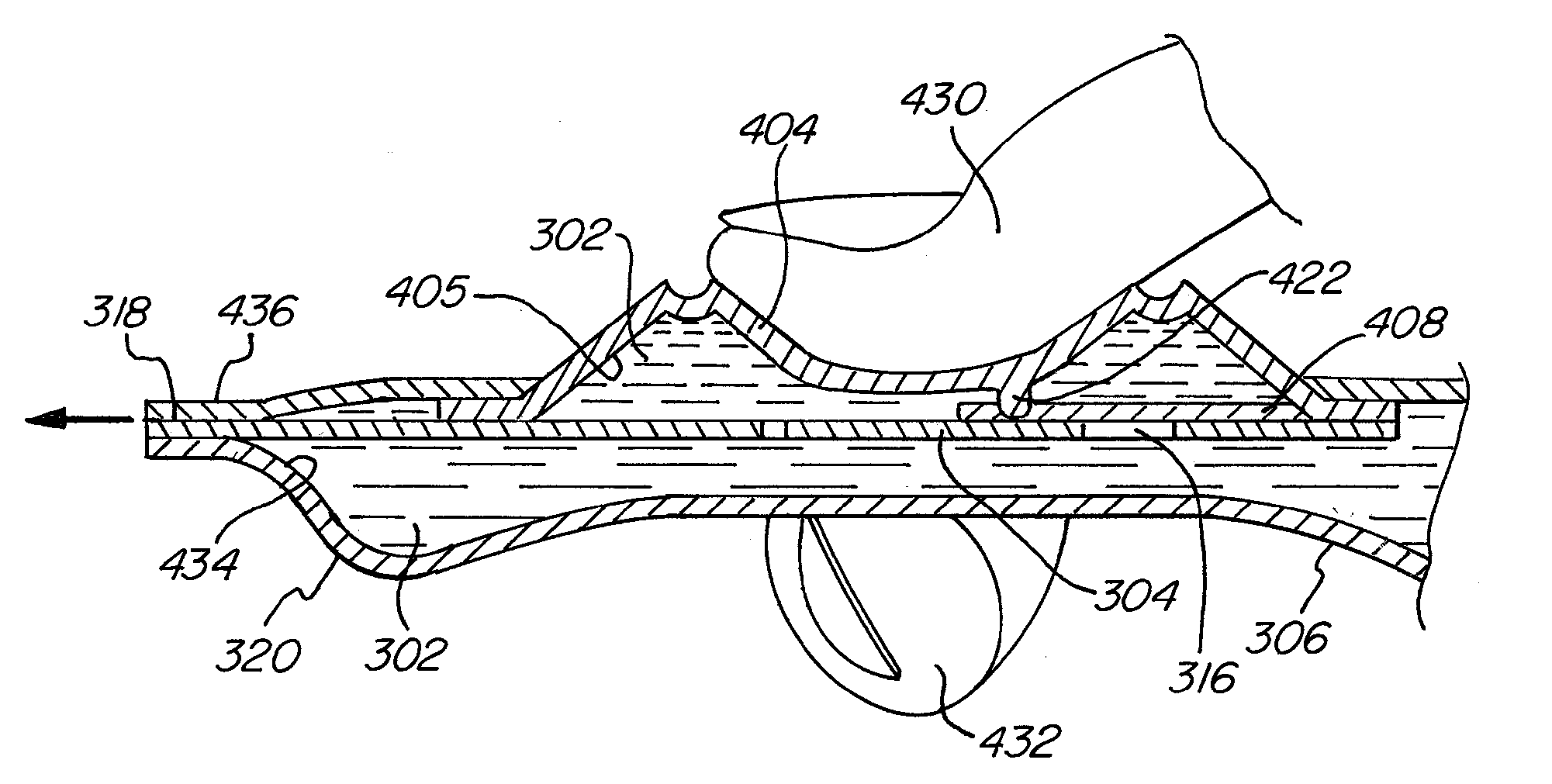 Metering Dispensing System With One-Piece Pump Assembly