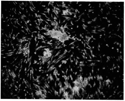 Efficient preparation method of placental mesenchymal stem cells through homogenizer