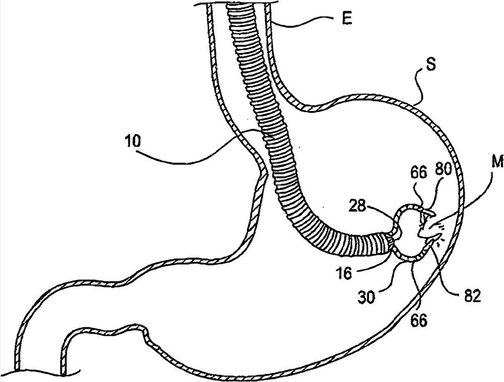 Endoscopic device with high moving freedom and operating method thereof