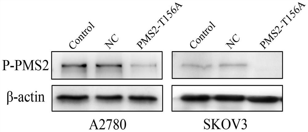 Application of Akt1 phosphorylated PMS2 protein as ovarian cancer treatment target