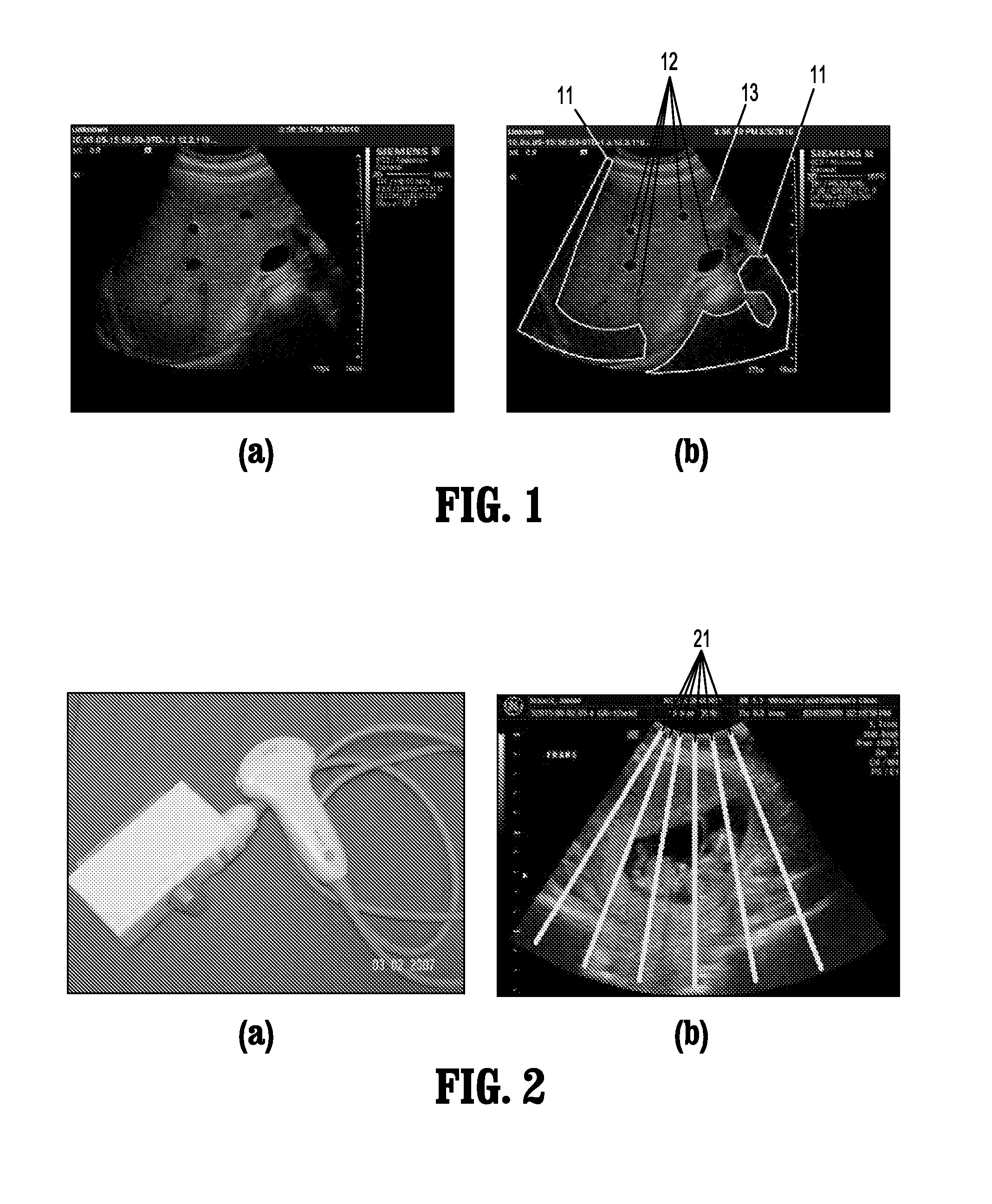 System and method for detection of acoustic shadows and automatic assessment of image usability in 3D ultrasound images