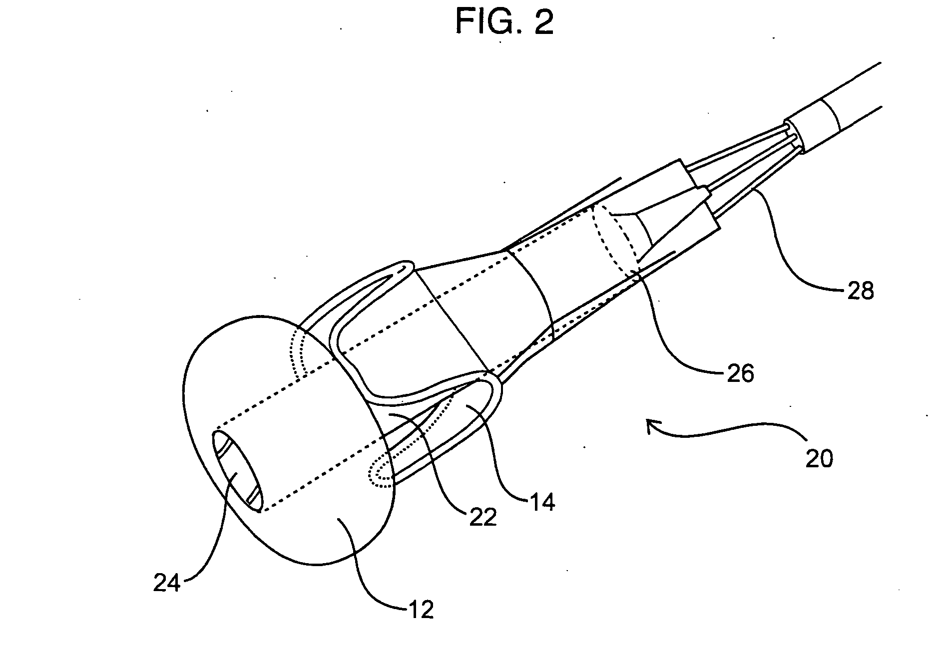 Devices and methods for percutaneously treating aortic valve stenosis