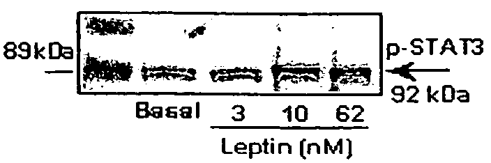 Leptin peptide antagonists