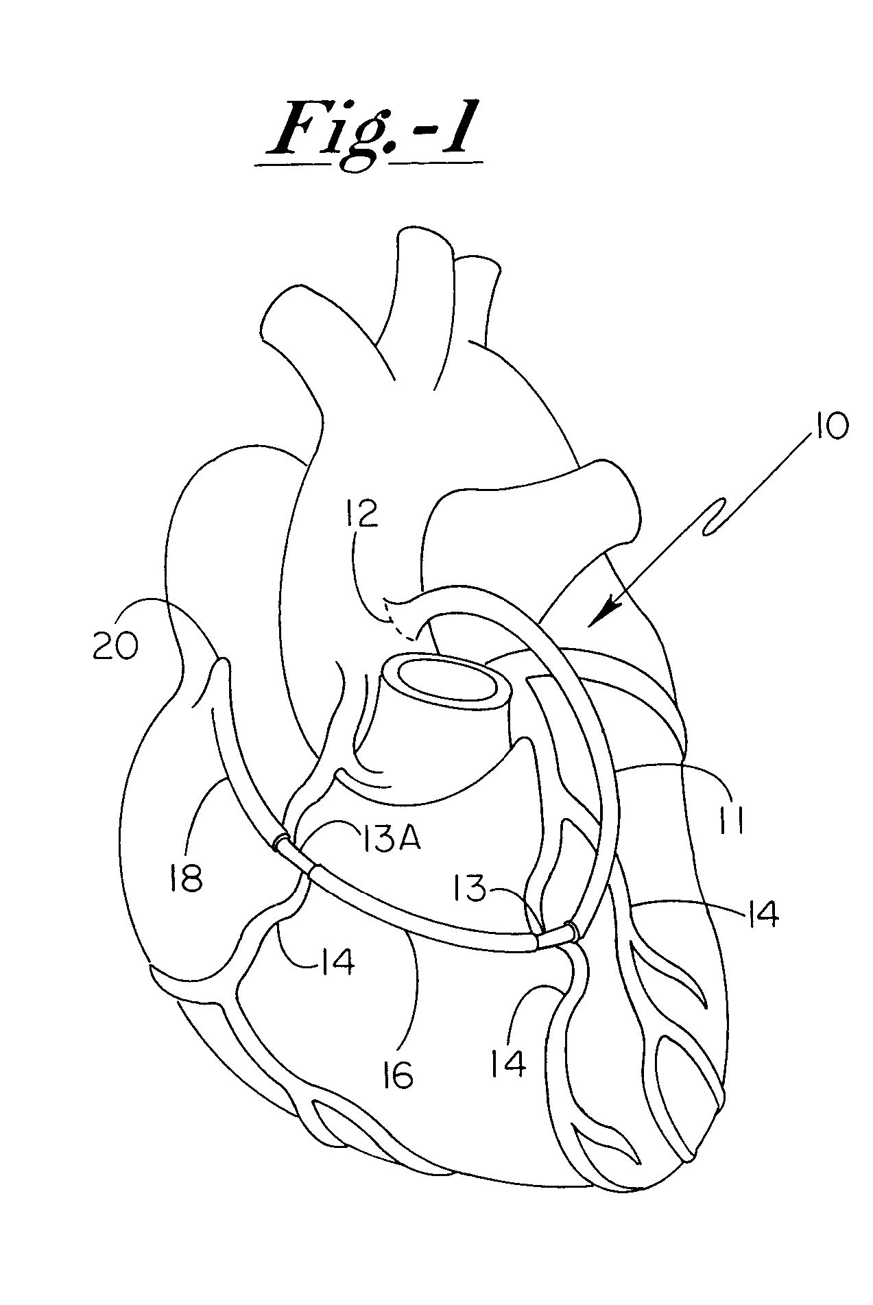 Grafted network incorporating a multiple channel fluid flow connector