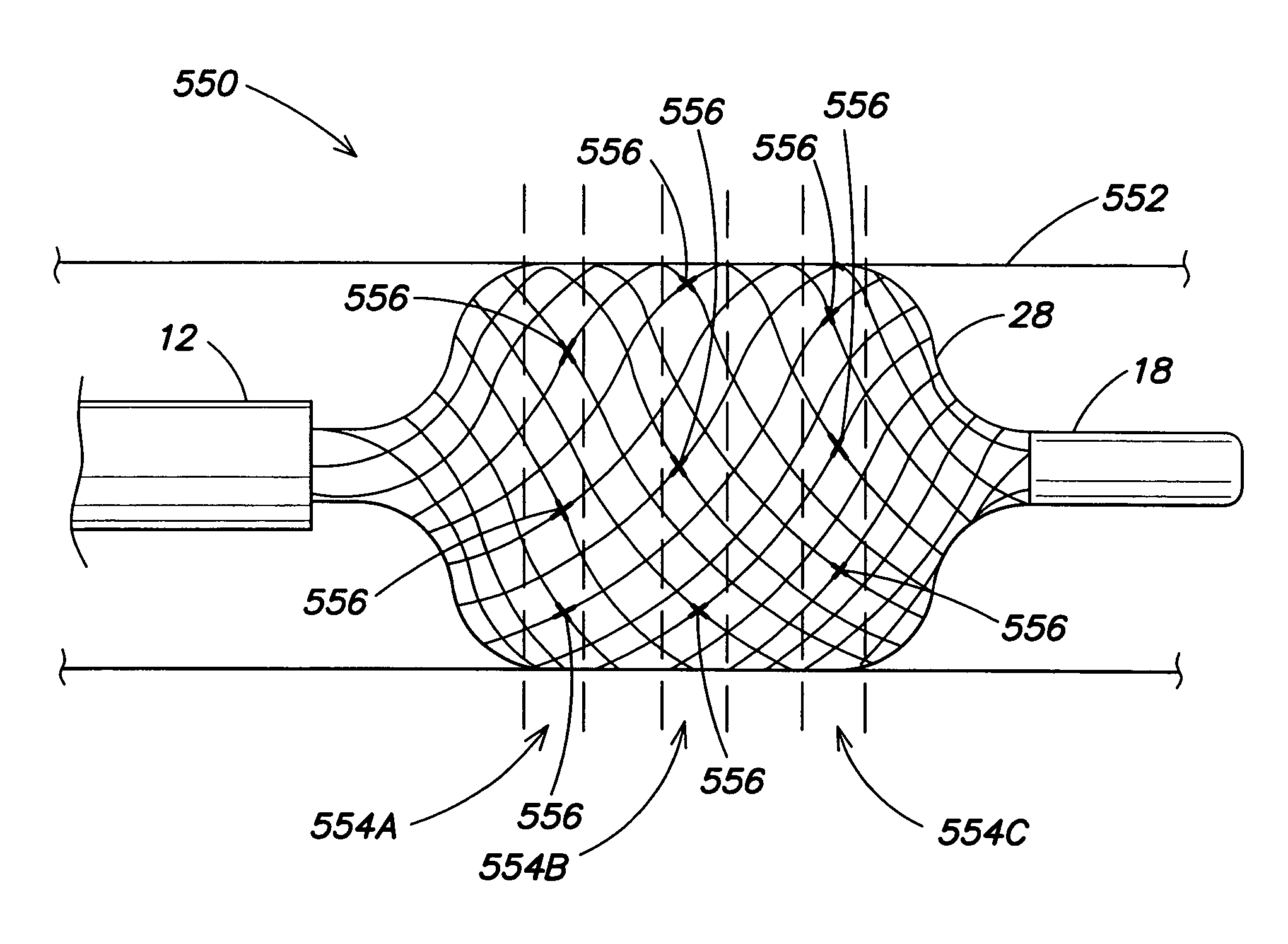 Systems and methods for three-dimensional mapping of electrical activity