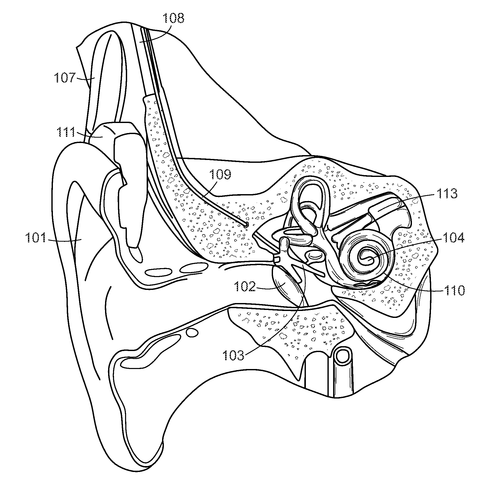 Skull Vibrational Unit