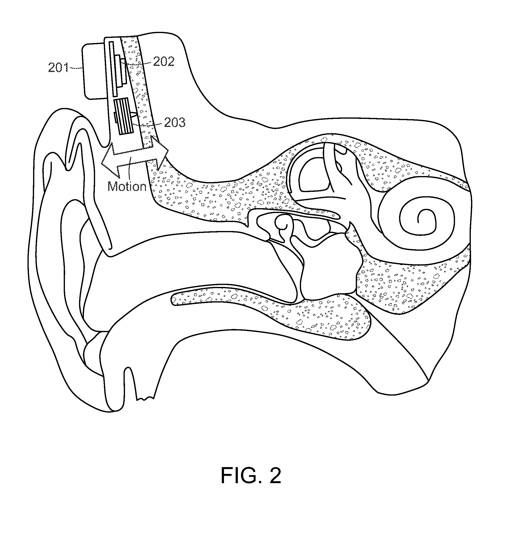 Skull Vibrational Unit