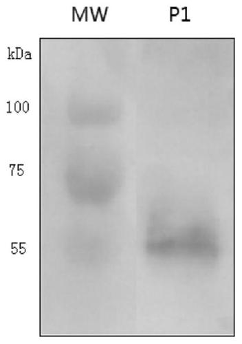 Anti-human Legumain protein monoclonal antibody, hybridoma cell strain LGMN-2 and applications thereof