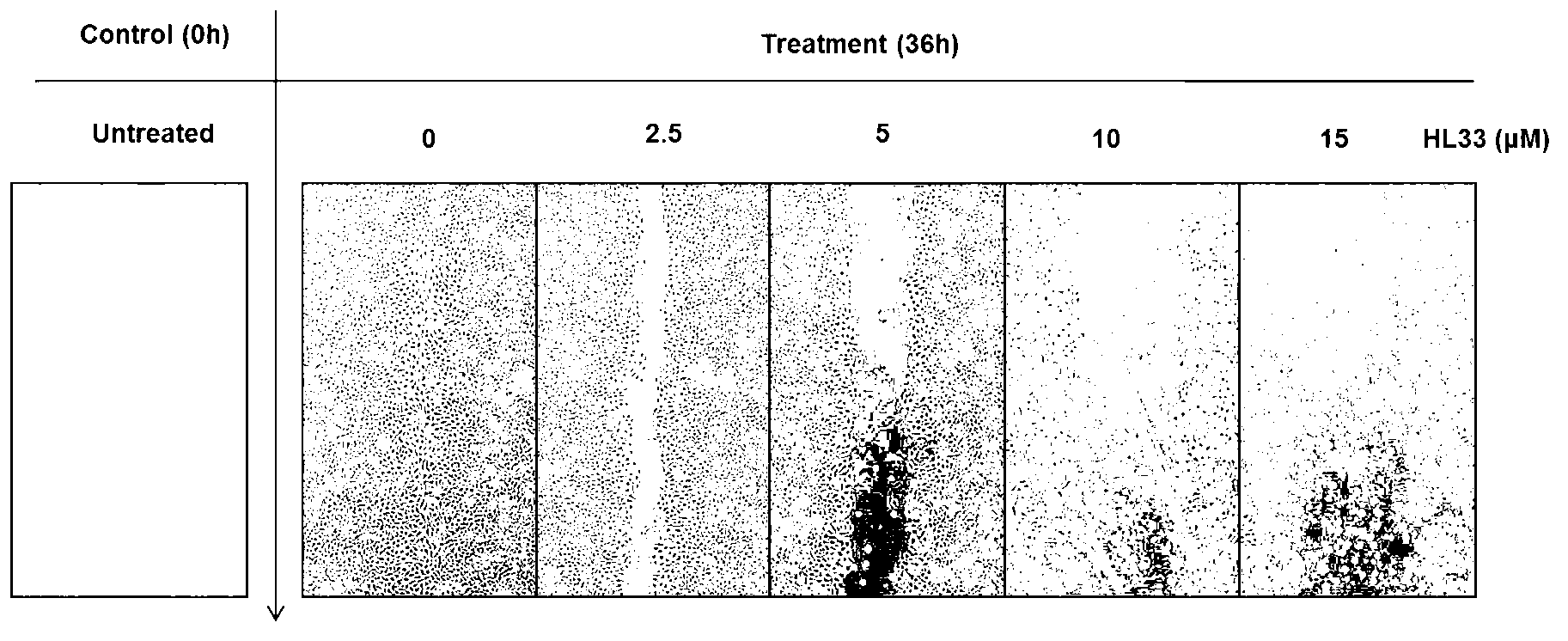 2-phenylnaphthalene derivative and application thereof in preparation of anti-tumor medicaments