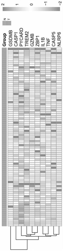 Application of combined pyroptosis related genes to esophageal adenocarcinoma prognosis model